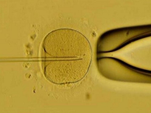 试管婴儿可以帮助染色体患者成功怀孕吗？
