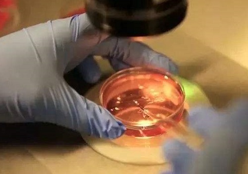试管婴儿怀孕后什么时候做产前筛查？