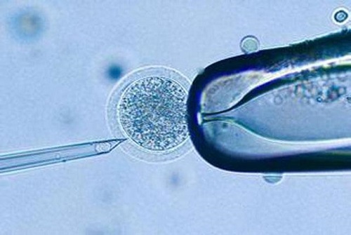 试管婴儿实验室形成的囊胚个数由什么决定？