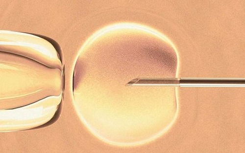 输卵管不同程度的堵塞是否都可以做泰国试管婴儿？